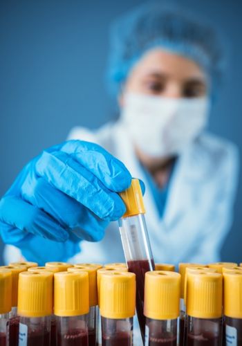 blood test
