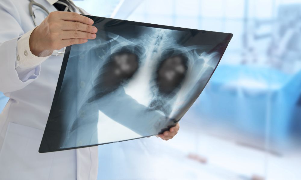 Urgent Care X-ray Services