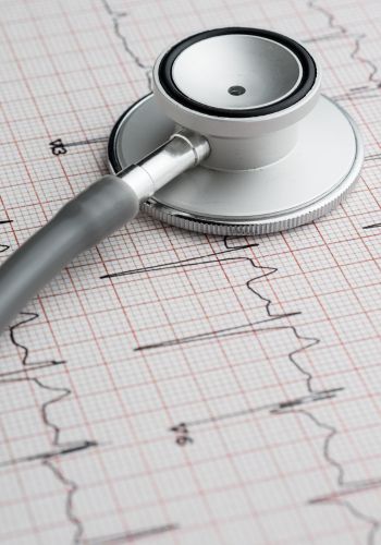 Diagnostic EKG