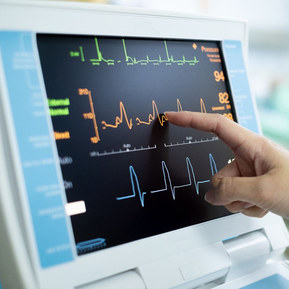 EKG Services