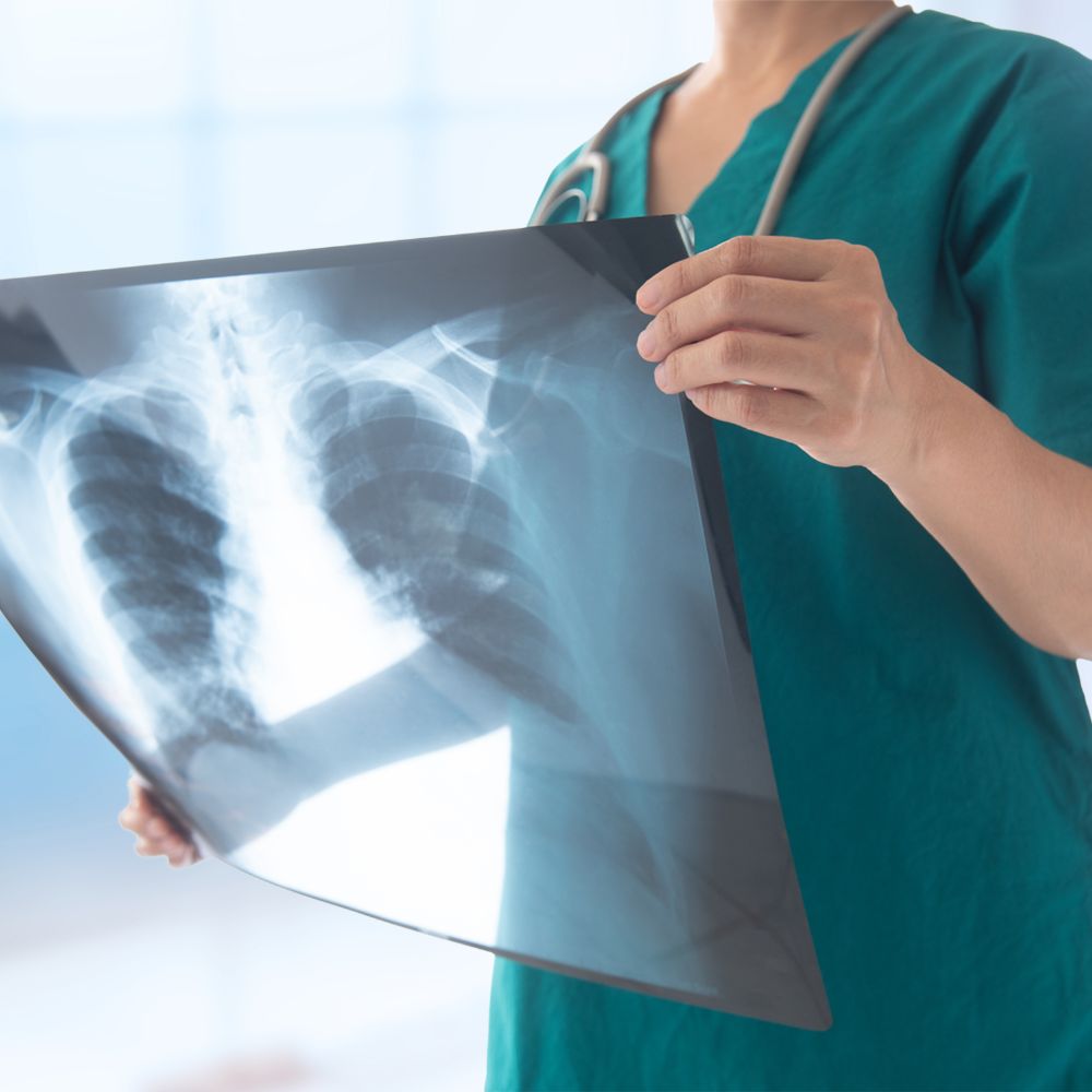 X-ray services in Western NewYork