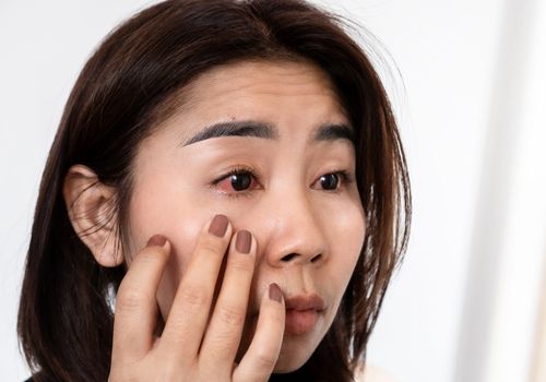 Treatment for Eye Infections