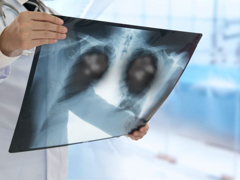 Urgent Care X-ray Services